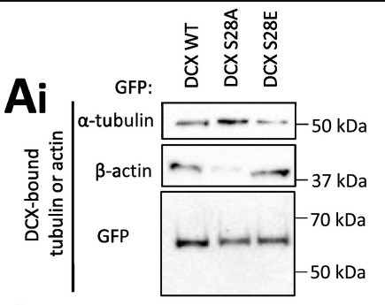 Immunoblotting was performed to detect the endogenous α-tubulin and DCX.jpg